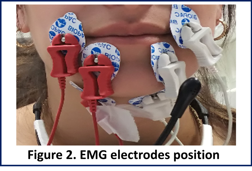 figure 2: emg electrodes position